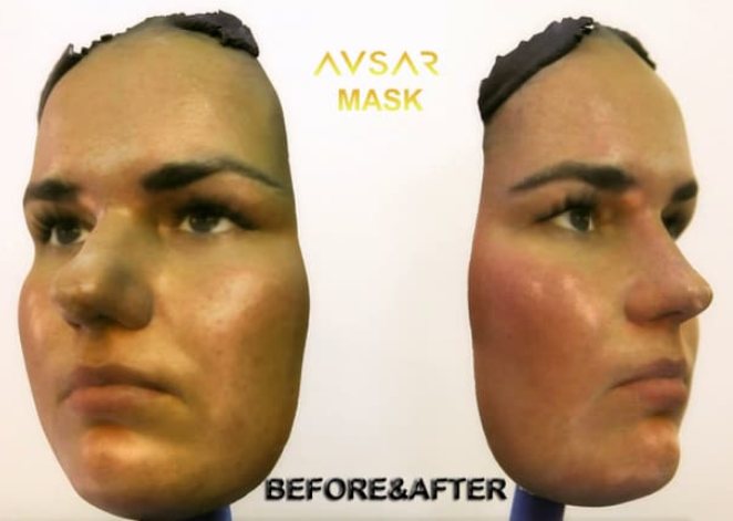 3D mask surgery